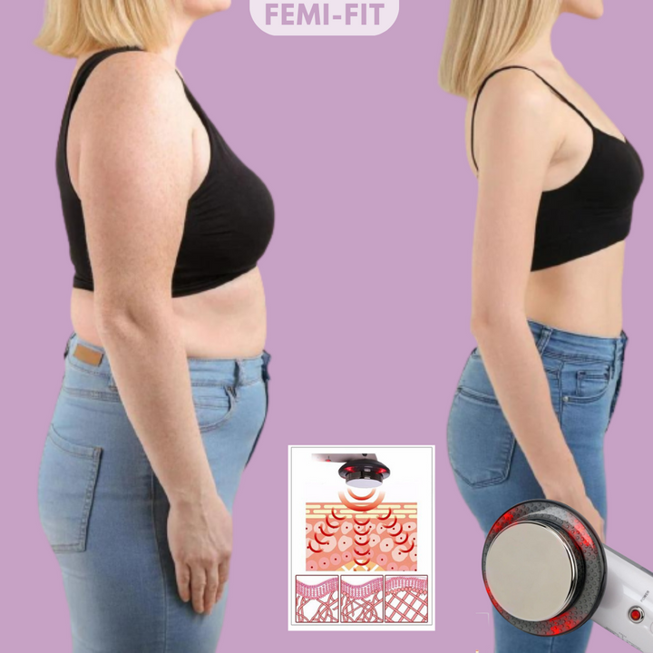Fjern Fett og Cellulitter 3-i-1 – SlimShape