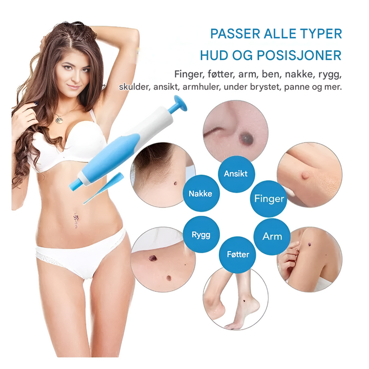 Fjerningssett for hudfliker